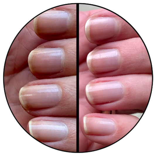 Nail Hardener results shown with natural nails before and after application for stronger, healthier nail care.