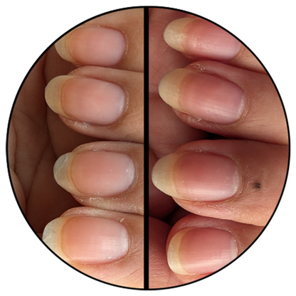 Close-up of natural nails before and after using Advanced Nail Strengthener showing stronger, healthier nail growth results